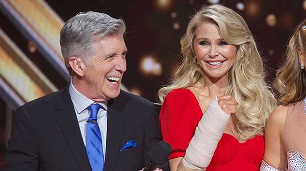 Christie Brinkley Shows Off Insane Arm Bruising After Dropping Out Of ‘DWTS’ For Brutal Injury