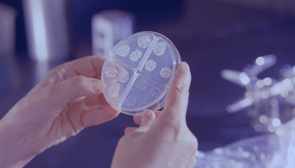 L'Oréal takes over Lactobio to strengthen microbiome research