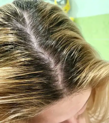 2 bad and 3 good tips for those whose hair…