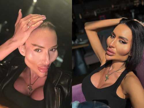 The Ukrainian woman with the biggest cheekbones in the world&hellip;